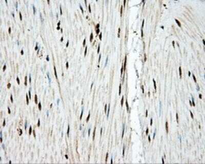 Immunohistochemistry: TLDC1 Antibody (OTI5D9) - Azide and BSA Free [NBP2-72091]