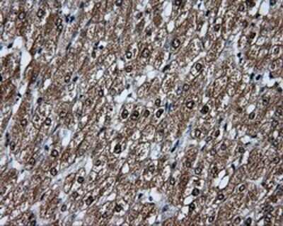 Immunohistochemistry: TLDC1 Antibody (OTI5D9) - Azide and BSA Free [NBP2-72091]
