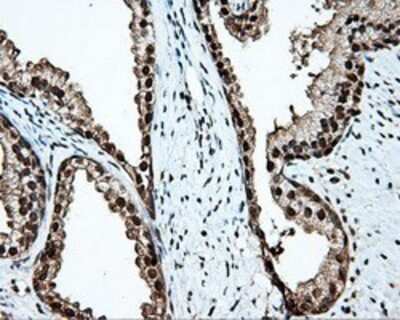 Immunohistochemistry: TLDC1 Antibody (OTI5D9) - Azide and BSA Free [NBP2-72091]