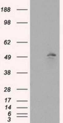 Western Blot: TLDC1 Antibody (OTI5D9)Azide and BSA Free [NBP2-72091]