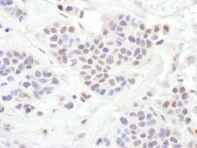 Immunohistochemistry-Paraffin: TLE1 Antibody [NBP2-04105]