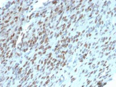 Immunohistochemistry-Paraffin: TLE1 Antibody (TLE1/2062) - Azide and BSA Free [NBP2-79914]