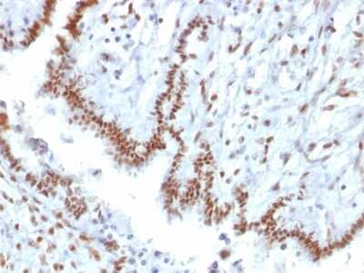 Immunohistochemistry-Paraffin: TLE1 Antibody (TLE1/2085) - Azide and BSA Free [NBP3-08727]