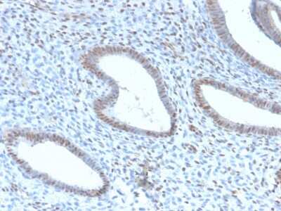 Immunohistochemistry-Paraffin: TLE1 Antibody (TLE1/2946R) - Azide and BSA Free [NBP3-08731]