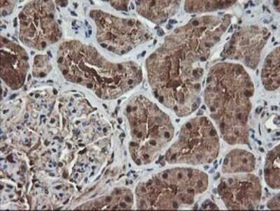 Immunohistochemistry: TLE2 Antibody (OTI5A6) - Azide and BSA Free [NBP2-74531]