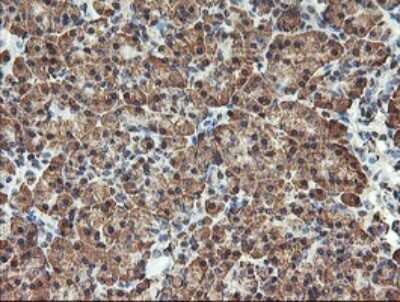 Immunohistochemistry: TLE2 Antibody (OTI5A6) - Azide and BSA Free [NBP2-74531]