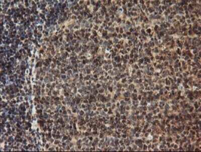 Immunohistochemistry: TLE2 Antibody (OTI5A6) - Azide and BSA Free [NBP2-74531]