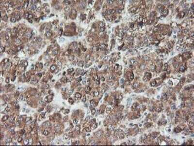 Immunohistochemistry-Paraffin: TLE2 Antibody (OTI5A6) [NBP2-01733]