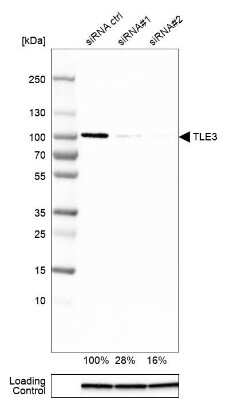 Western Blot: TLE3 Antibody (CL3573) [NBP2-61621]