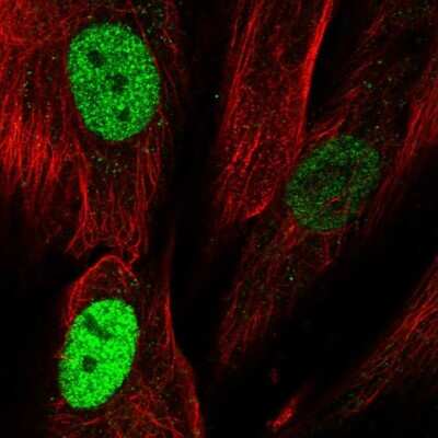 Immunocytochemistry/ Immunofluorescence: TLE4 Antibody [NBP2-55862]