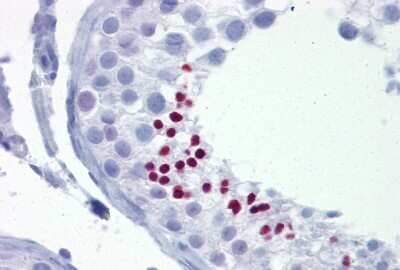 Immunohistochemistry: TLE4 Antibody [NBP2-88436]