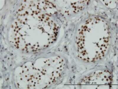 Immunohistochemistry-Paraffin: TLK1 Antibody (4B3) [H00009874-M01]