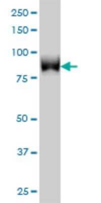 Western Blot: TLK1 Antibody (4B3) [H00009874-M01]