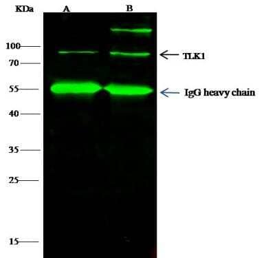 Immunoprecipitation: TLK1 Antibody [NBP2-98826]