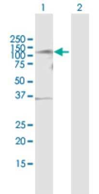 Western Blot: TLK1 Antibody [H00009874-B01P]