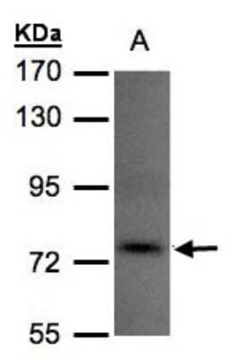 Western Blot: TLK1 Antibody [NBP1-32354]