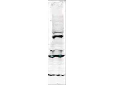 Western Blot: TLK1 Antibody [NBP1-77982]