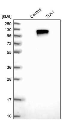 Western Blot: TLK1 Antibody [NBP1-83035]