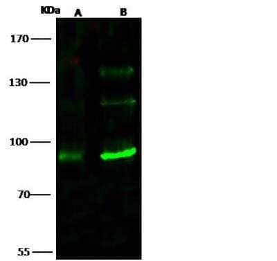 Western Blot: TLK1 Antibody [NBP2-98826]