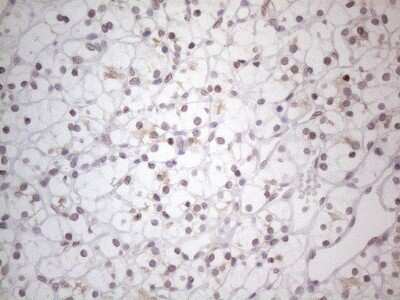 Immunohistochemistry: TLK2 Antibody (OTI2D10) [NBP2-46141]