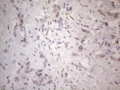Immunohistochemistry: TLK2 Antibody (OTI2D10) [NBP2-46141]