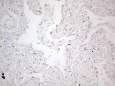 Immunohistochemistry: TLK2 Antibody (OTI2D10) [NBP2-46141]