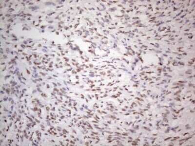 Immunohistochemistry: TLK2 Antibody (OTI2D10) [NBP2-46141]
