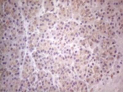 Immunohistochemistry: TLK2 Antibody (OTI2D10) [NBP2-46141]