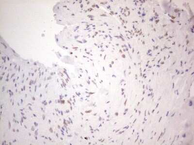 Immunohistochemistry: TLK2 Antibody (OTI2D10) [NBP2-46141]