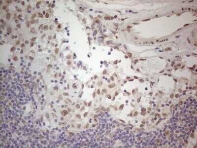 Immunohistochemistry: TLK2 Antibody (OTI2D10) [NBP2-46141]