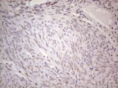 Immunohistochemistry: TLK2 Antibody (OTI2D10) [NBP2-46141]