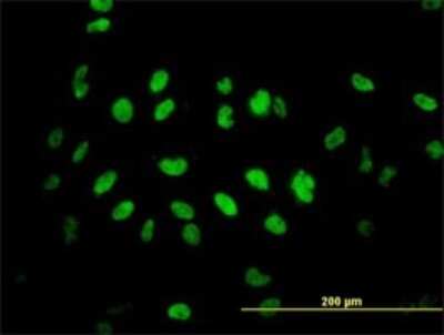 Immunocytochemistry/ Immunofluorescence: TLK2 Antibody (2G7) [H00011011-M01]