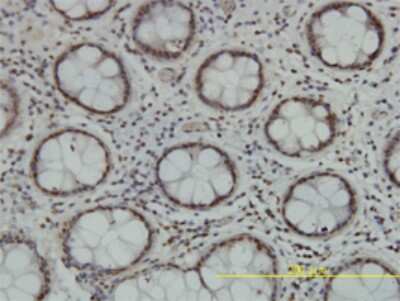 Immunohistochemistry-Paraffin: TLK2 Antibody (2G7) [H00011011-M01]