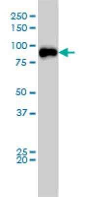 Western Blot: TLK2 Antibody (2G7) [H00011011-M01]