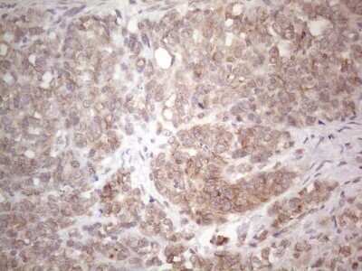 Immunohistochemistry: TLK2 Antibody (OTI2D10) - Azide and BSA Free [NBP2-74532]