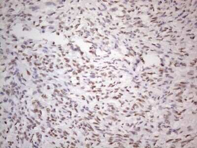 Immunohistochemistry: TLK2 Antibody (OTI2D10) - Azide and BSA Free [NBP2-74532]