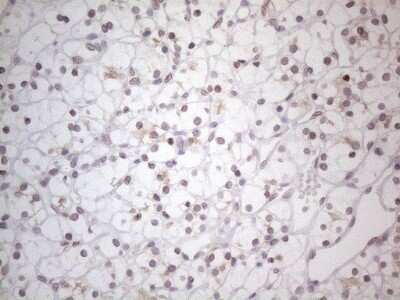 Immunohistochemistry: TLK2 Antibody (OTI2D10) - Azide and BSA Free [NBP2-74532]