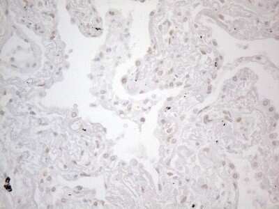 Immunohistochemistry: TLK2 Antibody (OTI2D10) - Azide and BSA Free [NBP2-74532]
