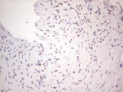 Immunohistochemistry: TLK2 Antibody (OTI2D10) - Azide and BSA Free [NBP2-74532]