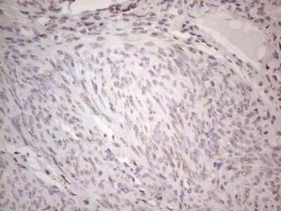 Immunohistochemistry: TLK2 Antibody (OTI2D10) - Azide and BSA Free [NBP2-74532]