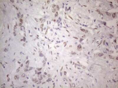 Immunohistochemistry: TLK2 Antibody (OTI2D10) - Azide and BSA Free [NBP2-74532]