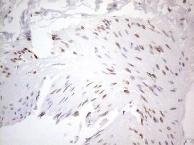 Immunohistochemistry: TLK2 Antibody (OTI2D10) - Azide and BSA Free [NBP2-74532]