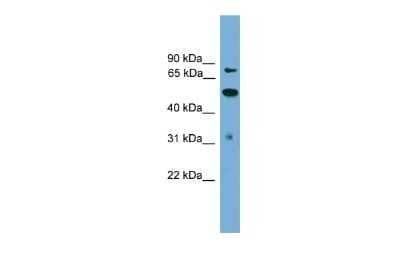 Western Blot: TLK2 Antibody [NBP2-82358]