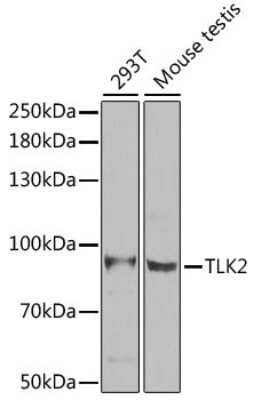 Western Blot: TLK2 AntibodyBSA Free [NBP2-95206]