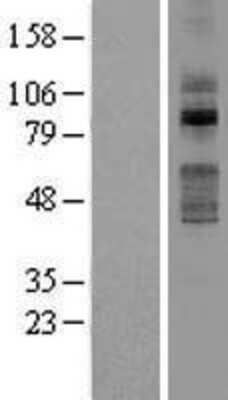 Western Blot: TLK2 Overexpression Lysate [NBL1-16948]