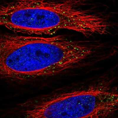 Immunocytochemistry/ Immunofluorescence: TLL1 Antibody [NBP2-56288]