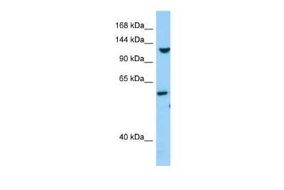 Western Blot: TLL1 Antibody [NBP2-85922]