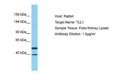 Western Blot: TLL1 Antibody [NBP2-85923]