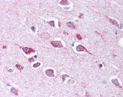 Immunohistochemistry-Paraffin: TLL2 Antibody - BSA Free [NBP1-44188]