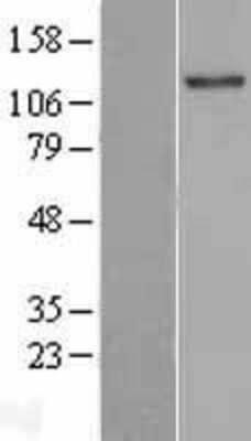 Western Blot: TLL2 Overexpression Lysate [NBL1-16949]